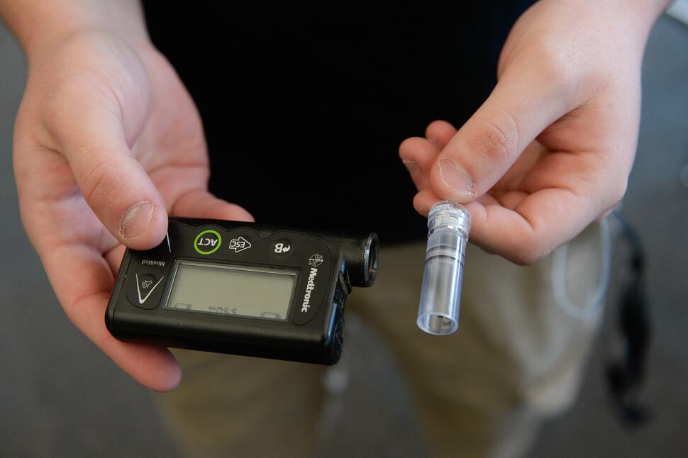 (Francisco Kjolseth | The Salt Lake Tribune) Dillon Hooley, 19, holds the insulin pump he uses to control his Type 1 diabetes. At one point, he started rationing his insulin because he was concerned with the financial strain it was causing the family.