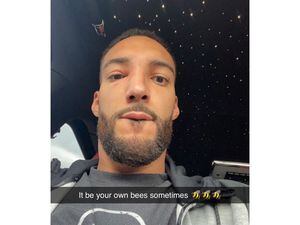 (Rudy Gobert, via Instagram) A photo posted on Utah Jazz center Rudy Gobert's Instagram profile shows his face after being stung by several bees in his Salt Lake City home.