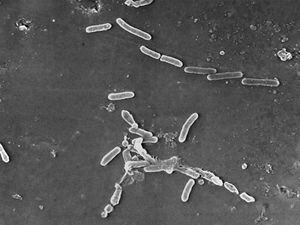 (Janice Haney Carr | CDC via AP) This scanning electron microscope image made available by the Centers for Disease Control and Prevention shows rod-shaped Pseudomonas aeruginosa bacteria. U.S. health officials are advising people to stop using the over-the-counter eye drops, EzriCare Artificial Tears, that have been linked to an outbreak of drug-resistant infections of Pseudomonas aeruginosa. The Centers for Disease Control and Prevention on Wednesday night, Feb. 1, 2023, sent a health alert to physicians, saying the outbreak includes at least 55 people in 12 states. One died.