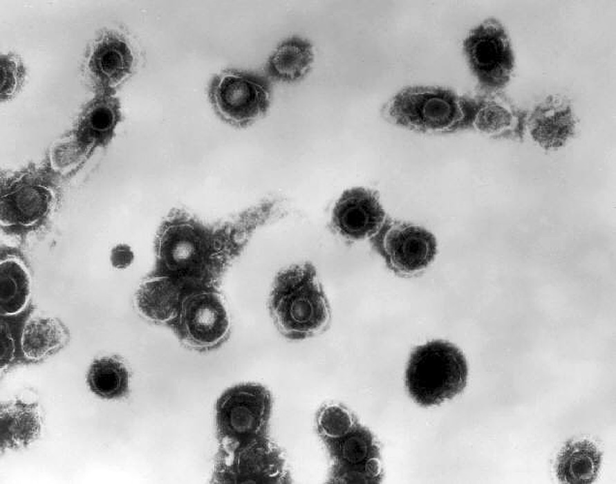 (Dr. Erskine Palmer | CDC | The Associated Press) This 1981 electron microscope image made available by the Centers for Disease Control and Prevention shows varicella-zoster virions from a patient with chickenpox. On Thursday, Oct. 11, 2018, the CDC says a small but growing proportion of U.S. toddlers have not been vaccinated against any disease.