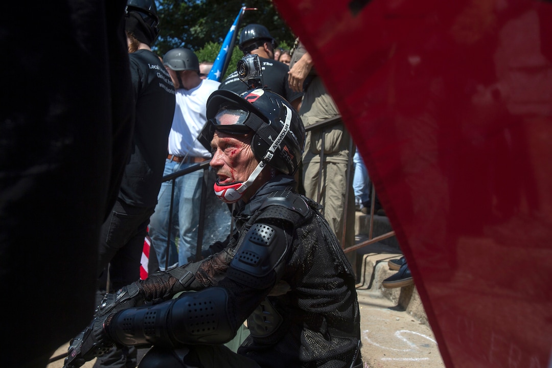 An injured man sits on the ground during a white nationalist rally on Saturday Aug. 12, 2017, in Charlottesville, Va. The group had gathered to protest plans by the city of Charlottesville to remove a statue of Confederate Gen. Robert E. Lee. (Shaban Athuman /Richmond Times-Dispatch via AP)