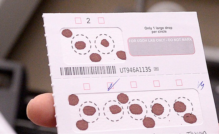Al Hartmann  |  The Salt Lake Tribune  Blood samples like this from every baby born in Utah are tested at the Utah Public Health Laboratory.  The Utah Department of Health announced they're going to start testing every infant born in the state for spinal muscular atrophy. The neurodegenerative disease is the leading genetic cause of death for infants, affecting one in 11,000.  
