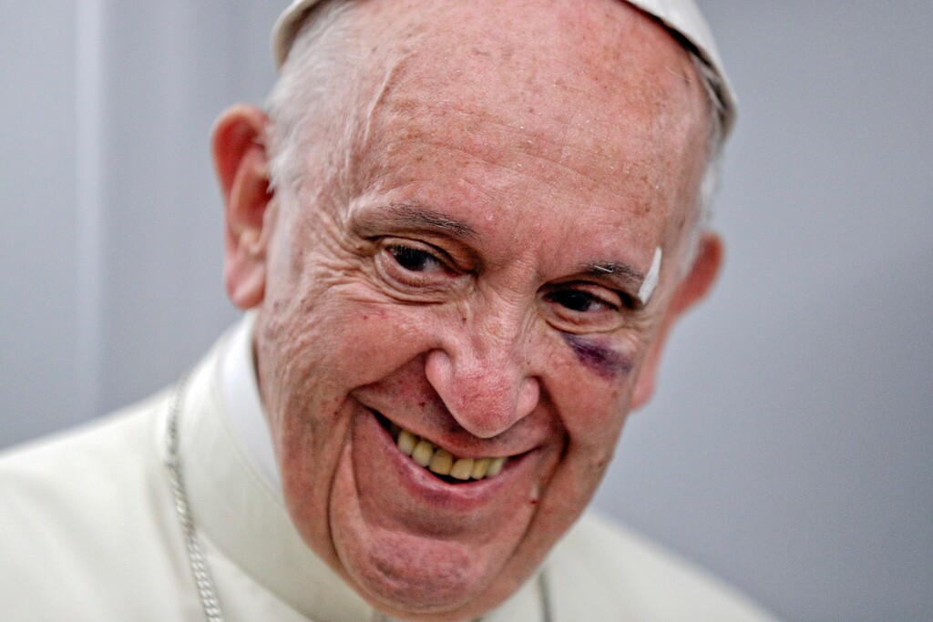 Pope Francis talks to journalists during a press conference he held on board the flight to Rome, at the end of a five-day visit to Colombia, Monday, Sept. 11, 2017. Francis' visit to Cartagena got off to a rocky start when he banged his head on his popemobile when it stopped short amid swarms of well-wishers. The pontiff, who only had a hip-high bar to hold onto, lost his balance and suffered a bruised, black left eye and a cut on his eyebrow. (AP Photo/Andrew Medichini, pool)