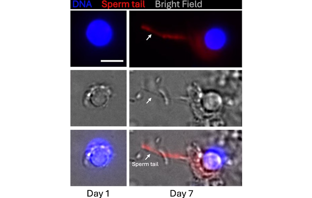 Pictures from a microscope show the tail of a sperm cell that Paterna Biosciences grew in a lab using testicular tissue.