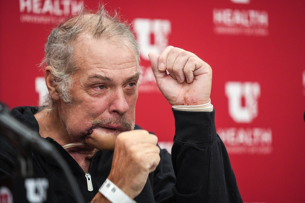 (Chris Samuels | The Salt Lake Tribune) Rudy Noorlander simulates Round 2 against the bear during a news conference at University of Utah Hospital in Salt Lake City, Friday, Oct. 13, 2023, after suffering a bear attack in September in Montana and undergoing surgery and treatment for the past five weeks.