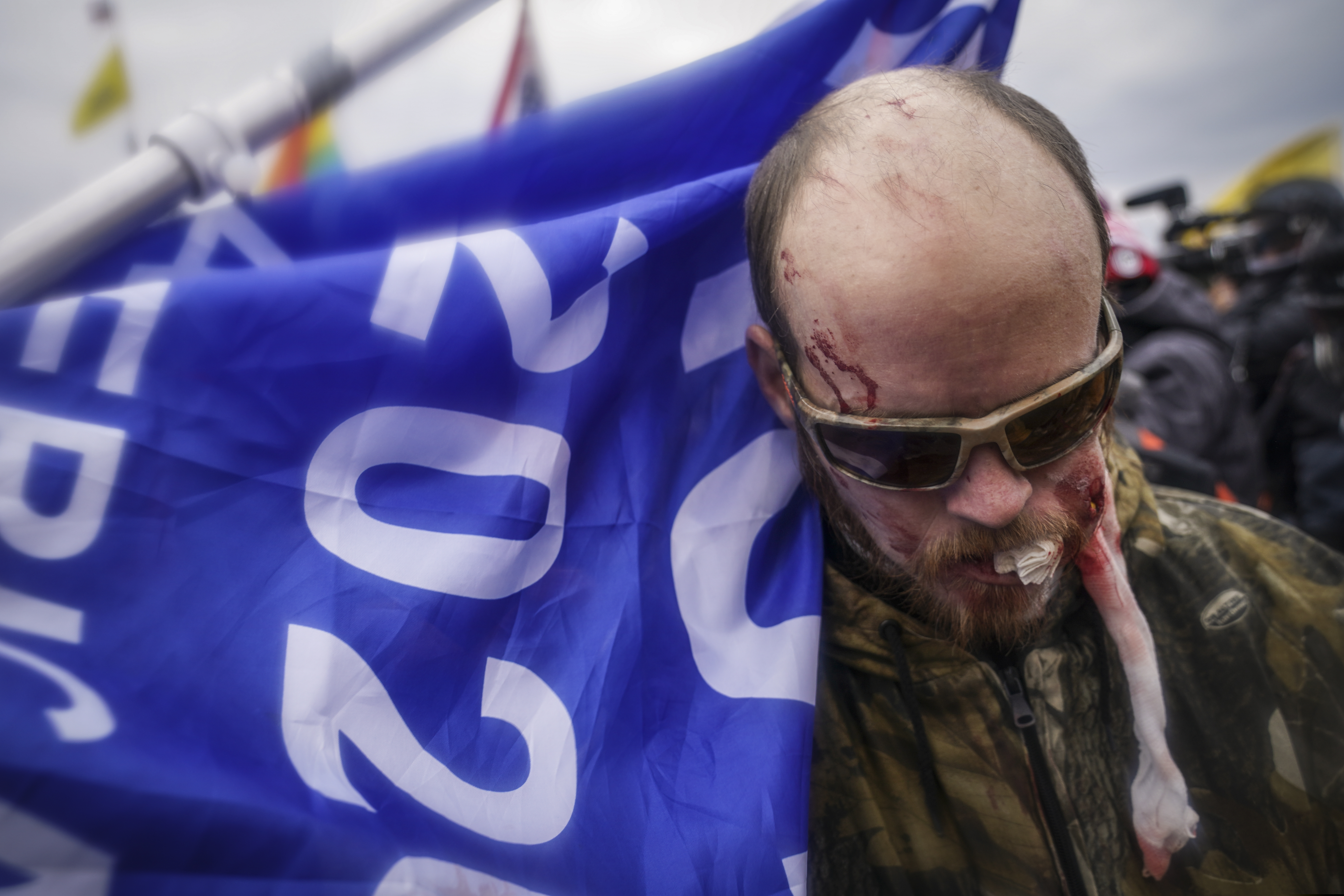 A protestor is shown injured during a confrontation with police during a rally Wednesday, Jan. 6, 2021, at the Capitol in Washington. As Congress prepares to affirm President-elect Joe Biden's victory, thousands of people have gathered to show their support for President Donald Trump and his claims of election fraud.(AP Photo/John Minchillo)