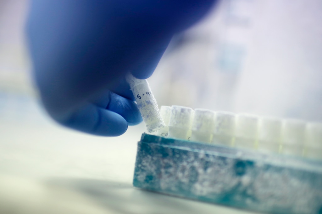 (Wong Maye-E | AP) In this Tuesday, May 15, 2018, photo, scientist Fabrice De Bond picks up a vial containing frozen donor sperm samples in a lab at Melbourne IVF in Melbourne, Australia. 