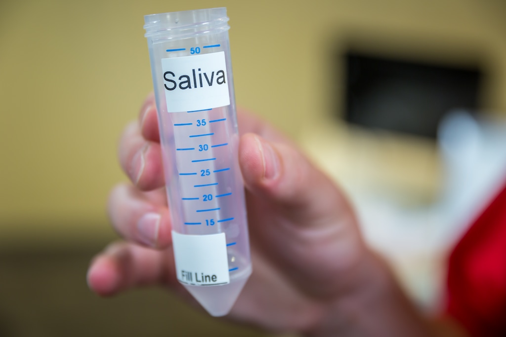(Photo courtesy of University of Utah Health) A worker holds a collection tube for saliva testing. University of Utah Health and ARUP announced on Thursday, Aug. 20, 2020, that they will begin collecting saliva samples for COVID-19 testing in some clinical settings.