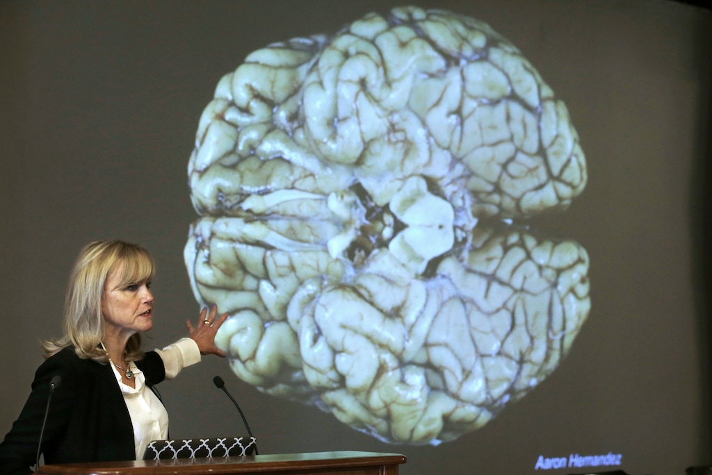 (Steven Senne | AP file photo) Ann McKee, director Boston University's center for research into the degenerative brain disease chronic traumatic encephalopathy, or CTE, addresses an audience on the school's campus about the study of NFL football player Aaron Hernandez's brain, projected on a screen behind in Boston in November 2017.