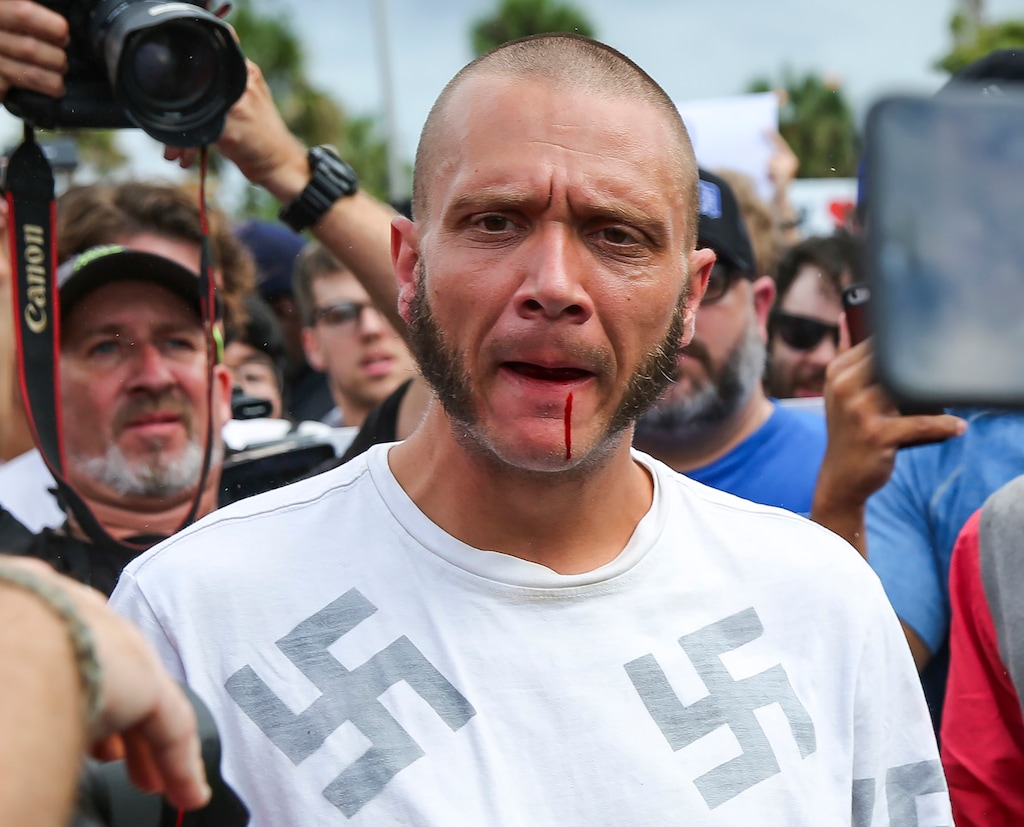 (Will Vragovic | Tampa Bay Times | The Associated Press) Blood runs from the lip of a man wearing a shirt with swastikas after he was punched by a protester outside a University of Florida auditorium where white nationalist Richard Spencer was preparing to speak, Thursday, Oct. 19, 2017 in Gainesville, Fla.