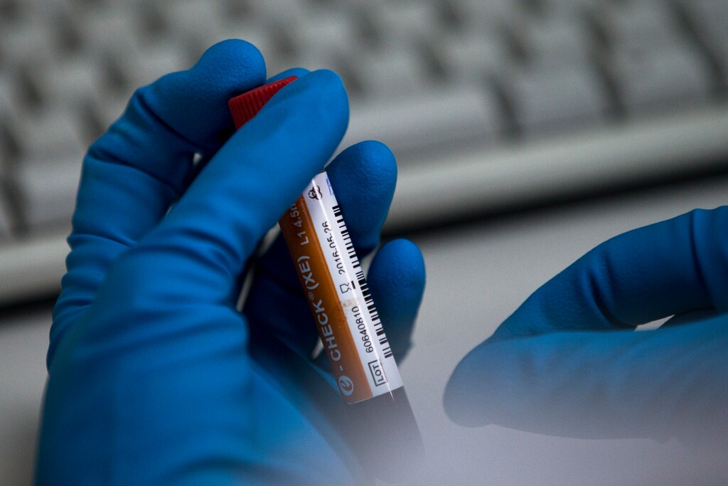 (Alexander Zemlianichenko | AP file photo)

In this Tuesday, May 24, 2016, photo an employee of the Russia's national drug-testing laboratory holds a vial in Moscow, Russia.