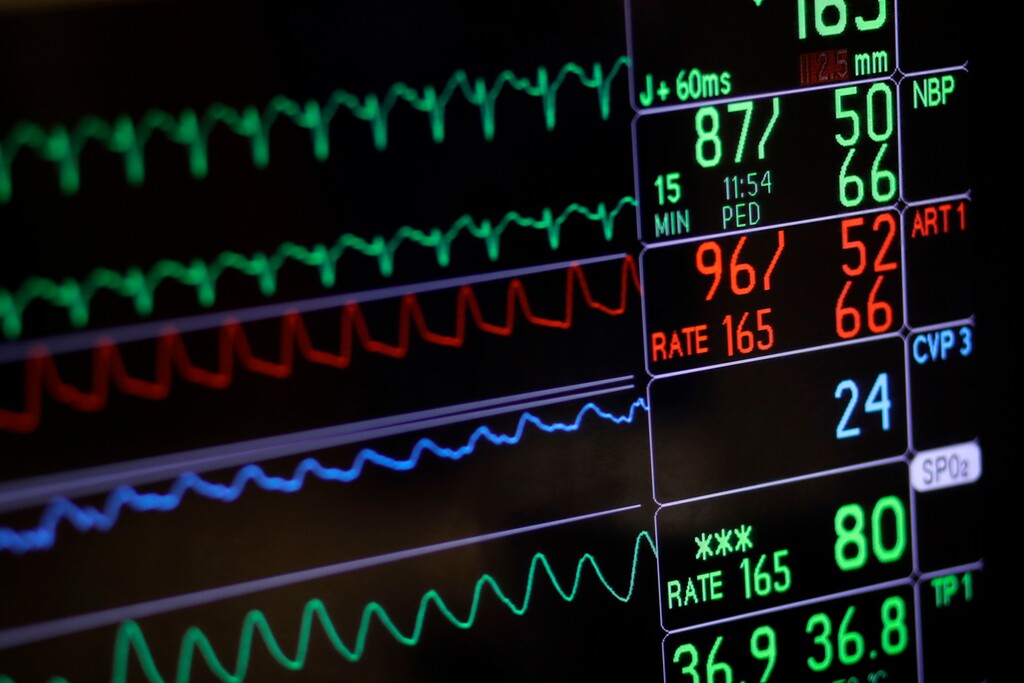 (Patrick Semansky | AP) In this Nov. 28, 2016, file photo, a screen displays a patient's vital signs during open heart surgery at the University of Maryland Medical Center in Baltimore. U.S. hospitals are now required to post list prices for medical services online, under federal rules meant to help patients find affordable care and avoid hefty surprise bills.
