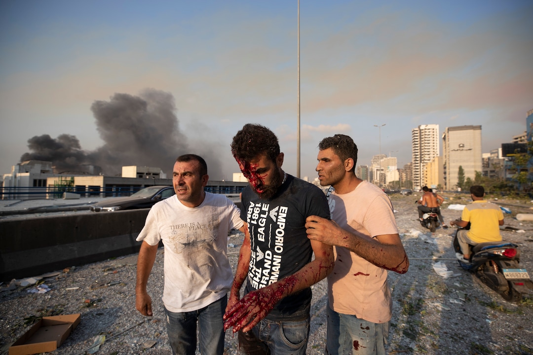 People help a man who was wounded in a massive explosion in Beirut, Lebanon, Tuesday, Aug. 4, 2020. Massive explosions rocked downtown Beirut on Tuesday, flattening much of the port, damaging buildings and blowing out windows and doors as a giant mushroom cloud rose above the capital. Witnesses saw many people injured by flying glass and debris. (AP Photo/Hassan Ammar)
