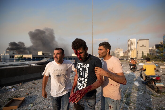 People help a man who was wounded in a massive explosion in Beirut, Lebanon, Tuesday, Aug. 4, 2020. Massive explosions rocked downtown Beirut on Tuesday, flattening much of the port, damaging buildings and blowing out windows and doors as a giant mushroom cloud rose above the capital. Witnesses saw many people injured by flying glass and debris. (AP Photo/Hassan Ammar)