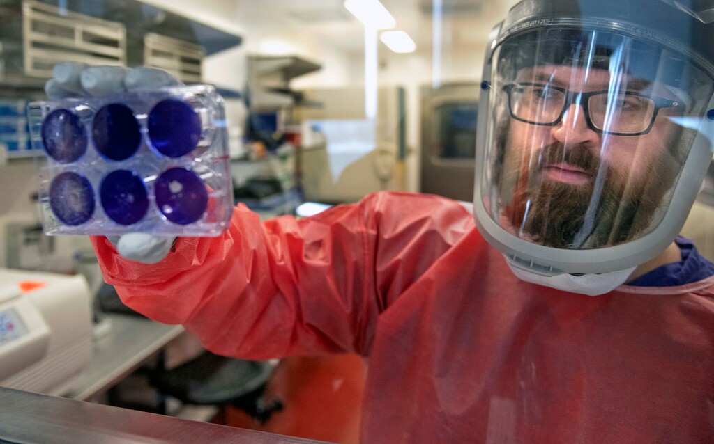 (Nate Guidry | Pittsburgh Post-Gazette via AP) Matt Dunn, a researcher for the Center for Vaccine Research at the University of Pittsburgh, holds dead samples of the coronavirus (COVID-19), Thursday, Feb. 27, 2020, at the Biomedical Science Tower 3 in Oakland, Pa.