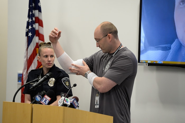 (Francisco Kjolseth  |  The Salt Lake Tribune)  Kaysville officer Cade Bradshaw describes some of the injuries he sustained along with officer Lacy Turner during a press event on Thursday, April 12, 2018. Four officers were injured on April 5, 2018, when responding to a suicidal man at a Chevron gas station store who had doused himself with gasoline. As the officers tried to get a lighter from the manÕs hand, the man lit himself on fire.