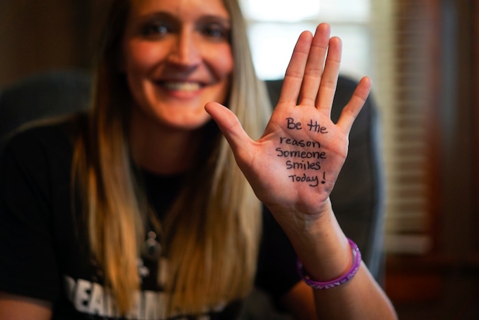 In this Aug. 9, 2017, photo, Koriann Evans, a former drug addict, holds up her hand to pose for a photo at her home in Bellevue, Ohio. Evans was hooked on heroin for over a decade until she overdosed while driving her car with her two children in the back, after which she stopped using drugs and started speaking about her former addiction. Police and rescue crews say drivers overdosing on heroin and other drugs are driving up the number of car crashes. (AP Photo/Dake Kang)