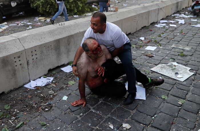 Lebanese man helps an injured man who was wounded by an explosion that hit the seaport, in Beirut Lebanon, Tuesday, Aug. 4, 2020. (AP Photo/Hussein Malla)