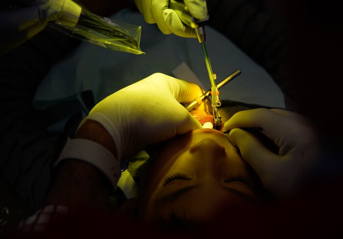 (Francisco Kjolseth  |  The Salt Lake Tribune) A young patient fills one of 60 chairs at the University of Utah dental school on Saturday, Feb. 29, 2020, as part of the American Dental AssociationÕs ÒGive Kids a SmileÓ program, that gives no-cost care to thousands of kids nationwide.
