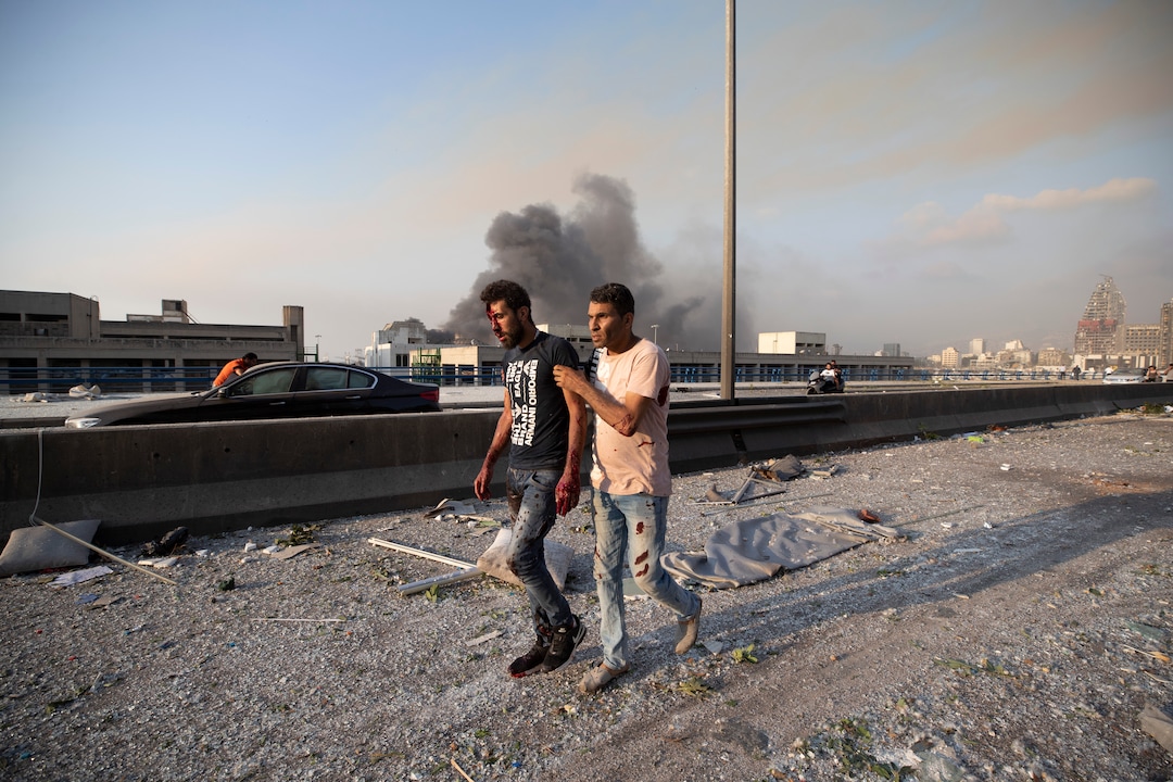 A man wounded in a massive explosion is led away in Beirut, Lebanon, Tuesday, Aug. 4, 2020. Massive explosions rocked downtown Beirut on Tuesday, flattening much of the port, damaging buildings and blowing out windows and doors as a giant mushroom cloud rose above the capital. Witnesses saw many people injured by flying glass and debris. (AP Photo/Hassan Ammar)