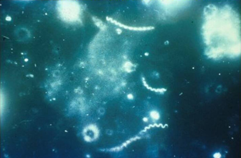 (Centers for Disease Control and Prevention) A darkfield micrograph of the bacterium that cause syphilis.