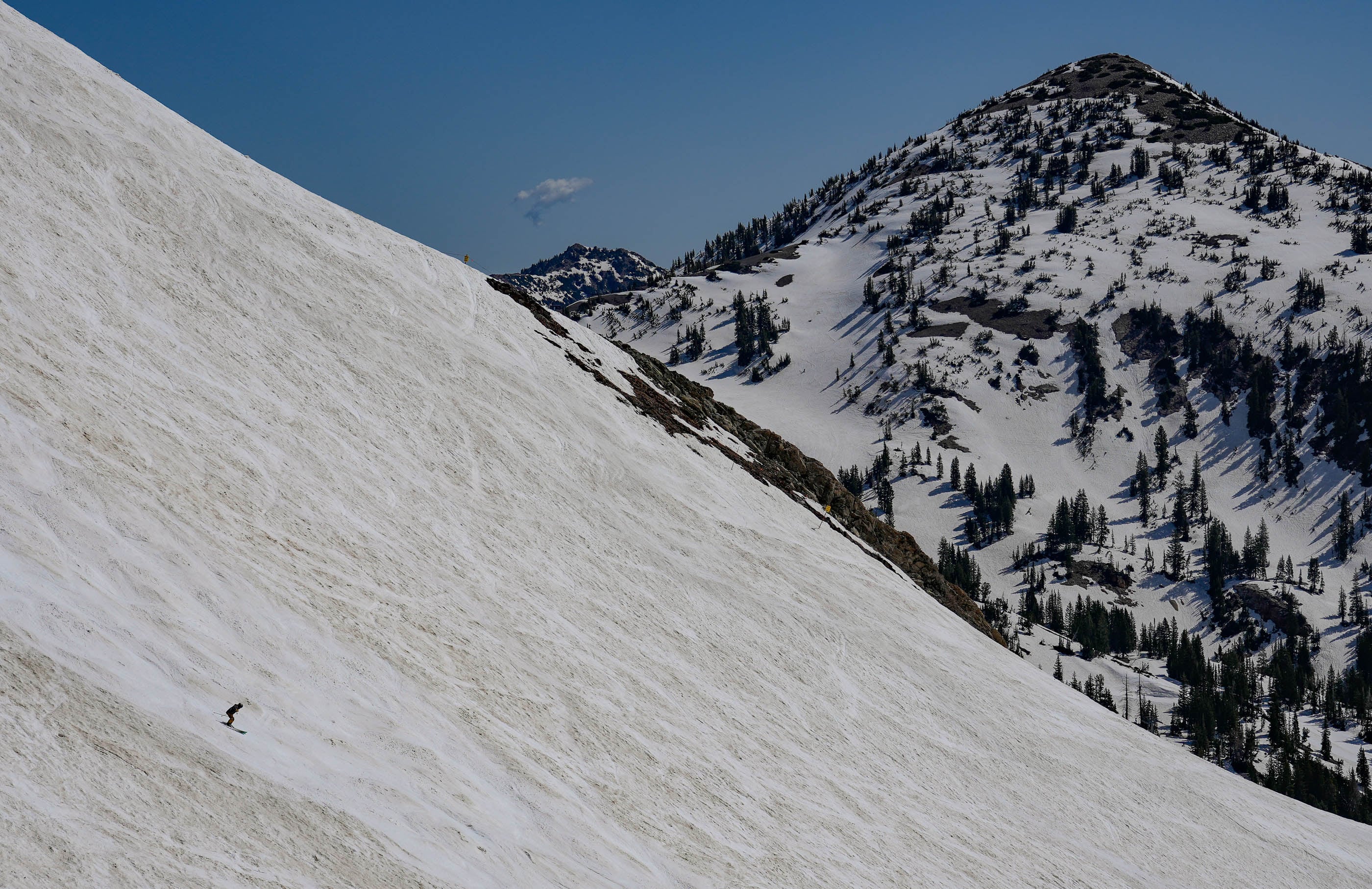 Featured image for article: Voices: I’m a medical student and former ski patroller. Here’s how to keep yourself — and others — safe on the slopes this season.