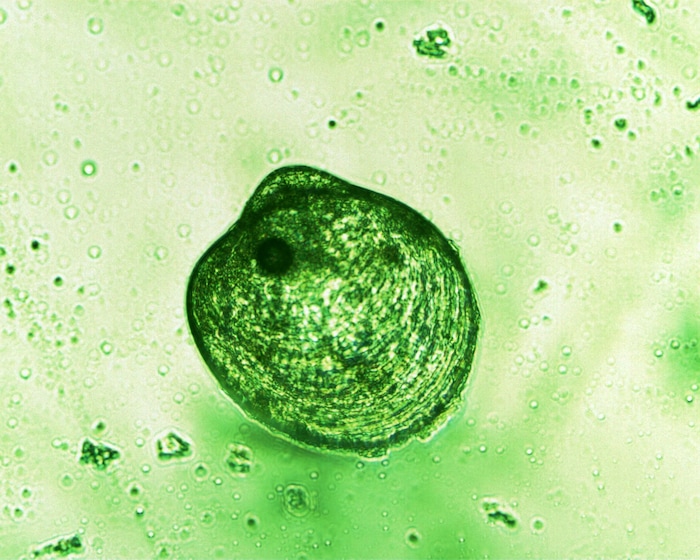 (Courtesy DWR) This is how the juvenile quagga mussels found in Deer Creek Reservoir in 2014 looked under a microscope.  After three years of monitoring and prevention efforts, quagga mussels have not reappeared.