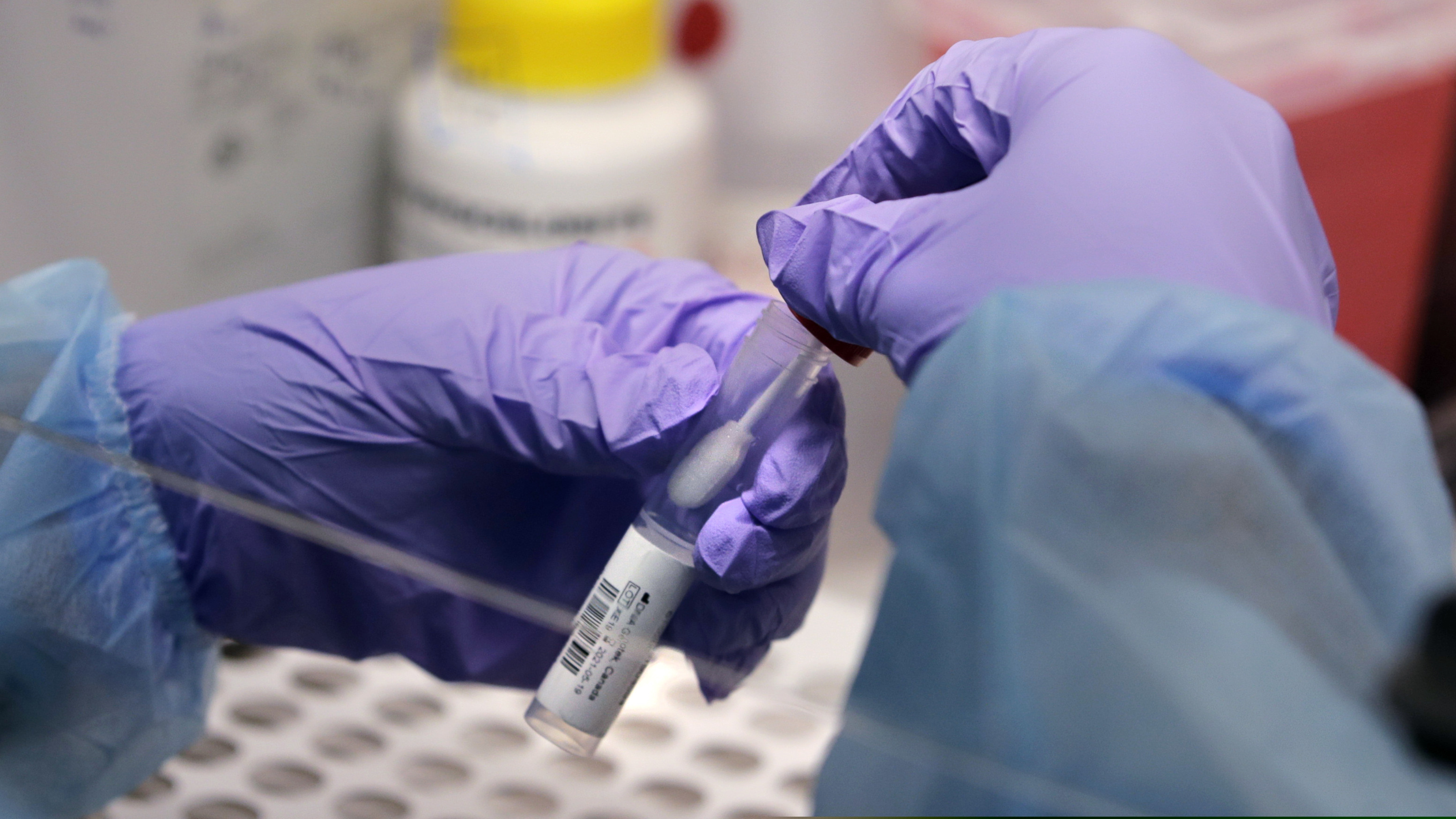 (Charles Krupa | AP file photo) A biomedical engineering graduate student handles a swab and specimen vial Thursday, July 23, 2020, in a new COVID-19 on-campus testing lab in Boston.