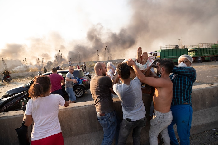 People evacuate wounded after of a massive explosion in Beirut, Lebanon, Tuesday, Aug. 4, 2020. Massive explosions rocked downtown Beirut on Tuesday, flattening much of the port, damaging buildings and blowing out windows and doors as a giant mushroom cloud rose above the capital. Witnesses saw many people injured by flying glass and debris. (AP Photo/Hassan Ammar)
