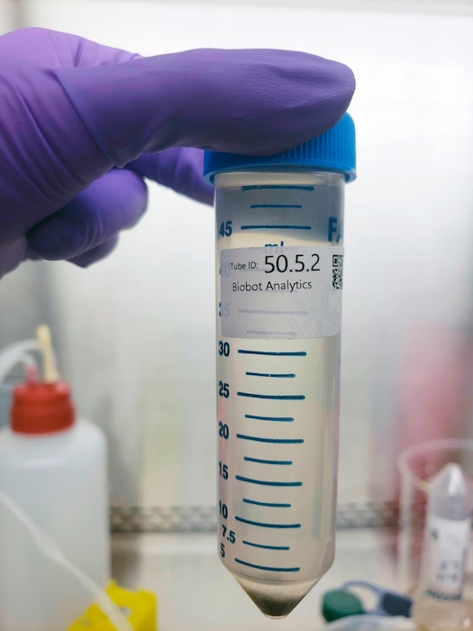 (Biobot via AP) In this undated photo provided by Biobot in June 2020, a technician holds a wastewater sampling tube. Across the U.S. and in Europe, researchers and health officials say they can track the course of a community outbreak by studying the waste flushed from its bathrooms. And that can provide a valuable addition to public health tools, they say.