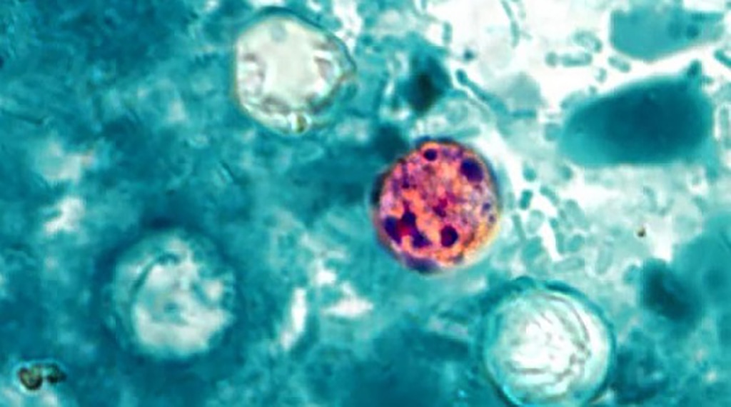 (CDC) A cyclosporiasis parasite seen under a microscope.