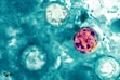 (CDC) A cyclosporiasis parasite seen under a microscope.