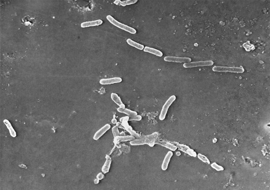 (Janice Haney Carr | CDC via AP) This scanning electron microscope image made available by the Centers for Disease Control and Prevention shows rod-shaped Pseudomonas aeruginosa bacteria. Experts are marveling at how U.S. disease detectives figured out how eyedrops were linked to dozens of infections.