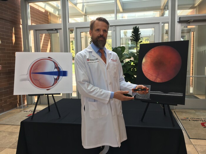 (Courtesy of John A. Moran Eye Center)  Jeff Pettey, an ophthalmologist at the John A. Moran Eye Center, demonstrated Wednesday how staring directly at the sun, without protective glasses, can cause permanent damage to the retina. His presentation underscored the need for eye protection when viewing the solar eclipse, which will be visible across the West on Aug. 21.