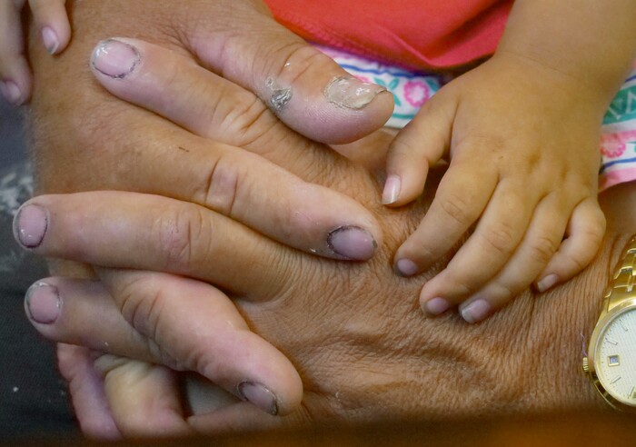 Romulo Gonzalez Rodriguez holds his 3-year-old daughter Genesis during a interview Tuesday, June 19, 2018, in Provo, Utah. Gonzalez Rodriguez spoke about the anguish of being separated from his 3-year-old daughter, Genesis Gonzalez Lopez, for seven days in November after arriving to the U.S. port of entry in San Diego. Gonzalez Rodriguez said he fled his hometown of Champerico, Guatemala to seek asylum in the United States after he was kidnapped and extorted by captors who cut his eye out and nearly killed him. (AP Photo/Rick Bowmer)