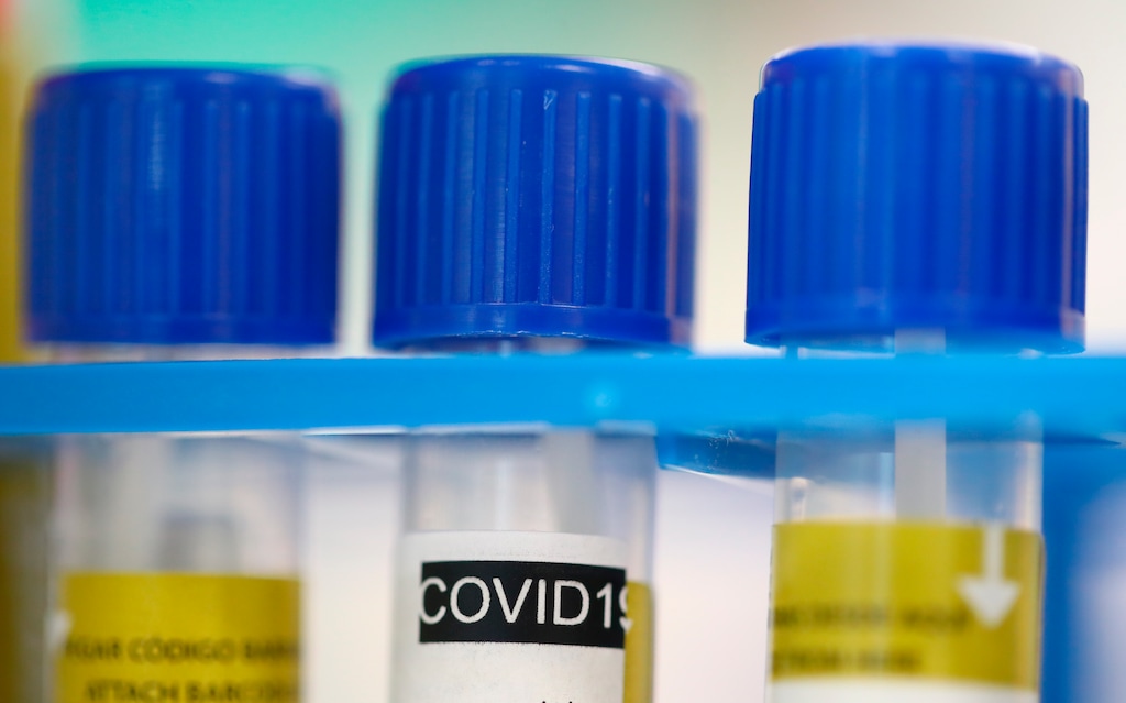 (Denis Balibouse  |  Associated Press) Tube tests stand in a holder at the Microbiology Laboratory of the University Hospital, CHUV, during the coronavirus disease (COVID-19) outbreak in Lausanne, Switzerland, Monday, March 23, 2020.