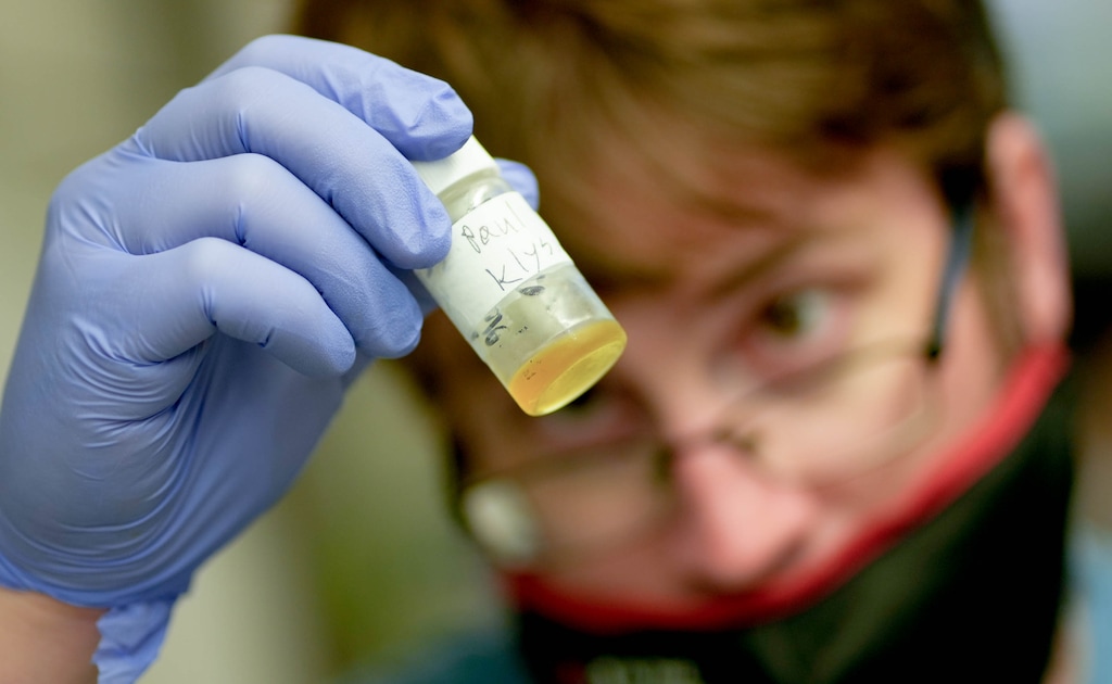 (Francisco Kjolseth | The Salt Lake Tribune) Researcher Paul Scesa holds a bottle containing a coral compound made in the lab at the University of Utah on Thursday, June 9, 2022, using genetically engineered yeast that could potentially create a drug to treat cancer. The U. announced on Tuesday, Sept. 9, 2025 that it's expanding its artificial intelligence efforts to try to speed up cancer research.