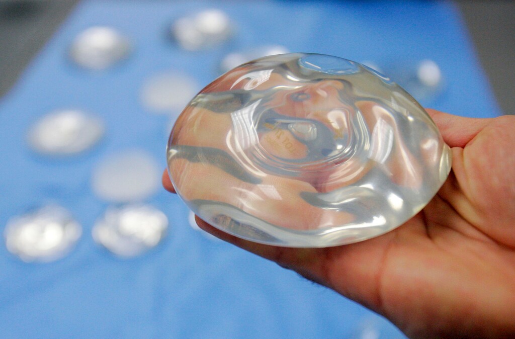 (Donna McWilliam | The Associated Press) This Dec. 11, 2006 file photo shows a silicone gel breast implant in Irving, Texas. U.S. health officials are taking another look at the safety of breast implants, the latest review in a decades-long debate. At a two-day meeting that starts Monday, March 25, 2019, a panel of experts for the U.S. Food and Drug Administration will hear from researchers, plastic surgeons and implant makers, as well as from women who believe their ailments were caused by the implants.