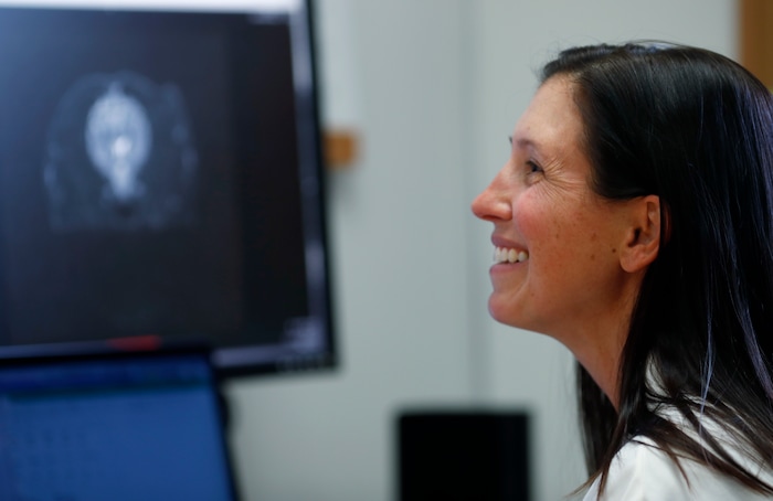 (David Zalubowski | The Associated Press) In this Monday, Nov. 6, 2017, photo, Dr. Stephanie McGrath checks over the scan of a dog enrolled in a study that she is leading to see the efficacy of CBD oil in the treating of dogs with epilepsy at Colorado State University in Fort Collins, Colo. McGrath said she hopes the results will be a stepping stone for longer and more diverse studies, and that they provide useful information for human medicine.