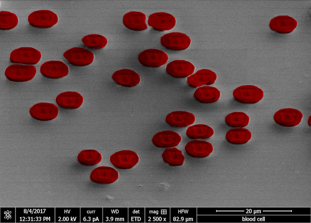 (Courtesy of Randy Polson | The University of Utah) This photo, entitled “The U is in my blood,” shows red blood cells belonging to Randy Polson, a research associate at the University of Utah, which Polson etched with the U.’s logo using a nano-scale ion beam system. Each cell is about 7 microns in diameter, roughly 10 times smaller than a human hair. The ion beam tool, housed at the U.’s Utah Nanofab on the College of Engineering campus, typically produces black and white images, so Polson colorized the red blood cells with software. The photo was produced for a monthly photo contest put on by FEI, an Oregon-based company that manufactures scientific microscopes.