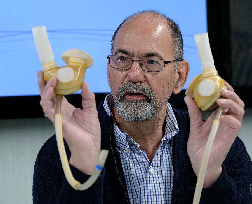(Al Hartmann | The Salt Lake Tribune) Brent Haupt, who received an artificial heart at Intermountain Medical Center's Artificial Heart Program, speaks at a news conference in Murray, Tuesday, May 1. He shows the first version of an artificial heart he received — the SynCardia Total Artificial Heart — that kept him alive before he eventually received a much smaller modern device. Patients, families and doctors reunited to celebrate the 25th anniversary of the hospital network’s pioneering artificial heart program, which has implanted more than 600 life-saving total artificial hearts and heart-assist devices during the past 25 years.
