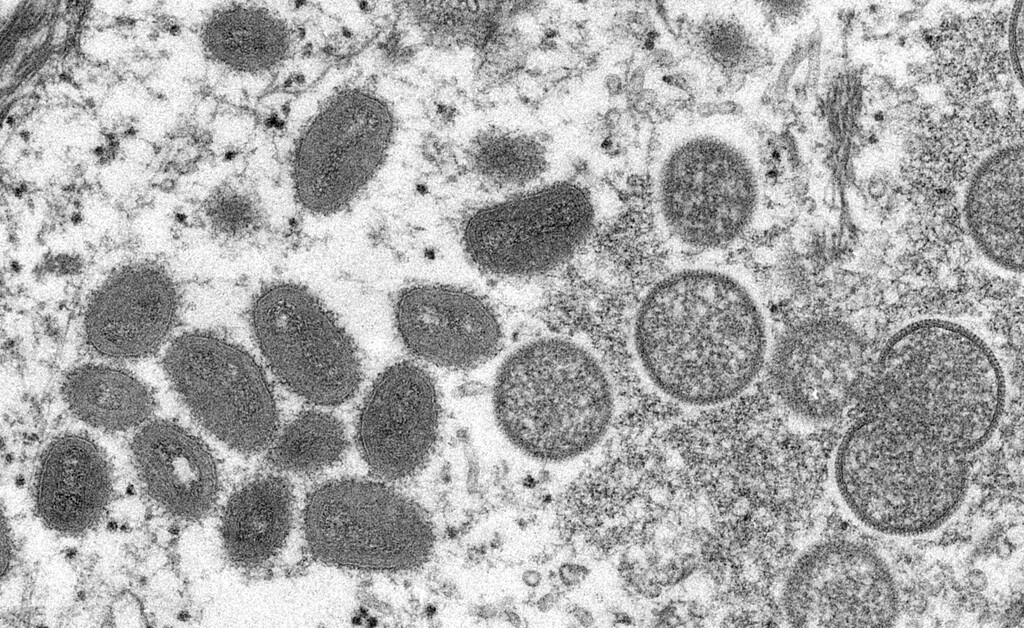 (CDC via The New York Times) An undated electron microscopy image provided by the Centers for Disease Control and Prevention of mature monkeypox virions, left, and immature virions, right, from a sample of human skin associated with the 2003 outbreak of monkeypox in the U.S.
