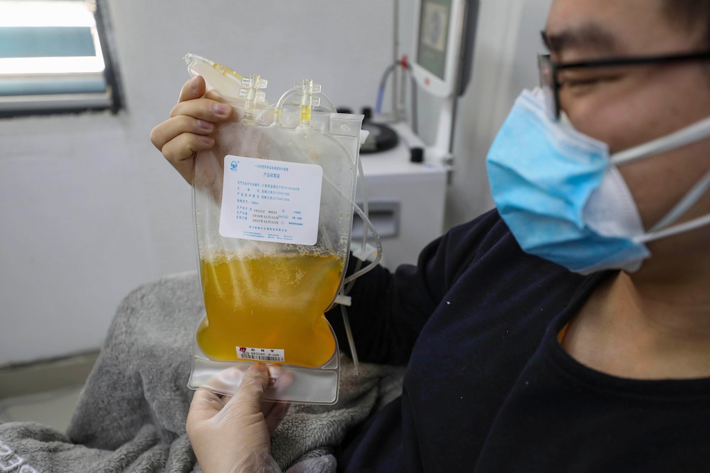 FILE - In this Feb. 18, 2020, file photo, Dr. Zhou Min, a recovered COVID-19 patient who has passed his 14-day quarantine, donates plasma in the city's blood center in Wuhan in central China's Hubei province. Plasma from recovered COVID-19 patients contains antibodies that may help reduce the viral load in patients that are fighting the disease. (Chinatopix via AP, File)
