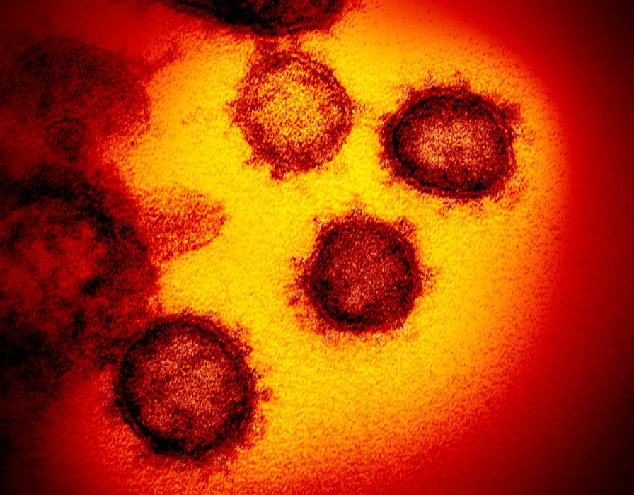 (NIAID-RML via AP) An electron microscope image made available by the U.S. National Institutes of Health in February 2020 shows the Novel Coronavirus SARS-CoV-2. Also known as 2019-nCoV, the virus causes COVID-19.