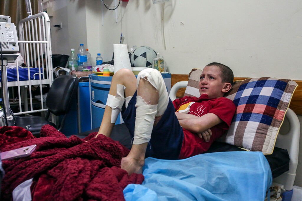 Mohamed Abu Rteinah, 12, who was burned when a bomb hit his home in late October 2023, recuperates in Gaza in November. A photojournalist followed some Palestinians whose worlds were ripped apart in one of the deadliest wars of the 21st century. 
CREDIT: (Samar Abu Elouf/The New York Times)