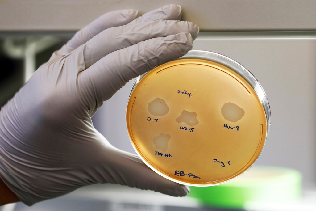(Richard Drew | AP photo)
Yale University researcher Benjamin Chan, who studies viruses that attack bacteria, holds a petri dish containing Pseudomonas aeruginosa lung samples grown from patient Ella Balasa, at Osborne Memorial Laboratories, in New Haven, Conn., Thursday Jan. 17, 2019. Pitting one germ against another may sound radical, but it’s a sign of a growing global crisis. Increasingly people are dying of infections that once were easy to treat, as common bacteria evolve to resist drugs that form the foundation of modern medicine.