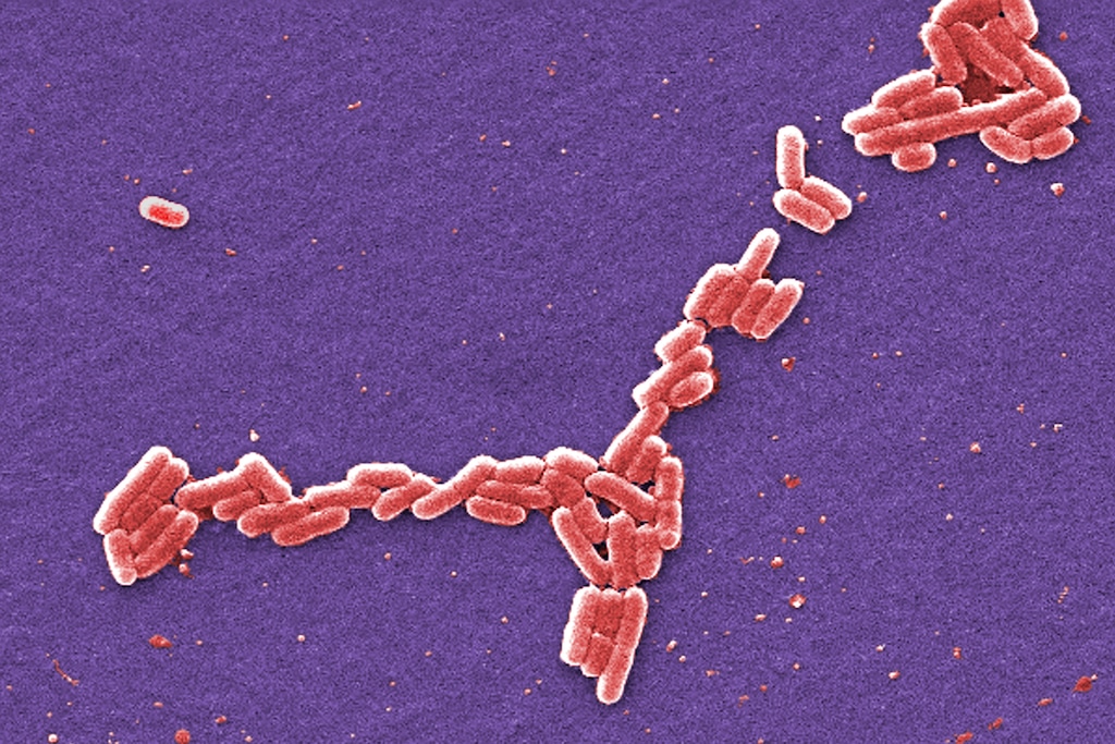 (Janice Haney Carr/CDC via AP) This colorized 2006 scanning electron microscope image made available by the Centers for Disease Control and Prevention shows E. coli bacteria of the O157:H7 strain that produces a powerful toxin which can cause illness. The city of Lehi is urging residents not to drink or recreate in pressurized irrigation water amid an E. coli outbreak that has sickened at least 12 people.