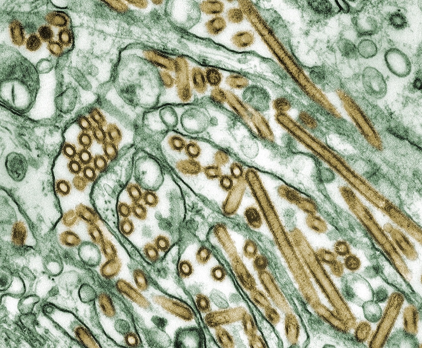 (CDC Public Health Image Library) A transmission electron microscope image of an avian flu strain, seen in gold, grown in canine kidney tissue epithelial cells, seen in green. The Utah Department of Agriculture and Food reported on Oct. 30, 2024, that avian flu was found in eight commercial dairies in Cache County.