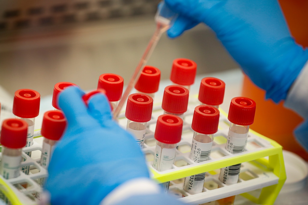 FILE - In this Wednesday, March 11, 2020 file photo, a technician prepares COVID-19 coronavirus patient samples for testing at a laboratory in New York's Long Island. A series of missteps at the nation's top public health agency caused a critical shortage of reliable laboratory tests for the coronavirus, hobbling the federal response as the pandemic spread across the country like wildfire, an Associated Press review found. (AP Photo/John Minchillo)