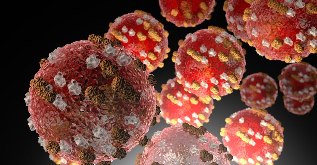(Centers for Disease Control and Prevention) An example of a measles virus. Utah now has its first verified case of measles.